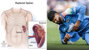 Shreyas Iyer ICU: డేంజ‌ర్‌లో శ్రేయాస్ అయ్యర్… అస‌లు గాయం ఎక్క‌డ అయిందంటే
