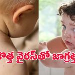 Tomato virus: పిల్లల్లో టమాటా వైరస్.. ఇది ఎలా వ్యాప్తి చెందుతోంది? లక్షణాలేమిటీ?