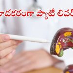 Fatty Liver Disease: ప్రతి ముగ్గురిలో ఒకరికి ఫ్యాటీ లివర్ సమస్య.. ప్రారంభ లక్షణాలివే !