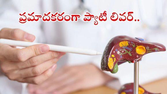 Fatty Liver Disease: ప్రతి ముగ్గురిలో ఒకరికి ఫ్యాటీ లివర్ సమస్య.. ప్రారంభ లక్షణాలివే !