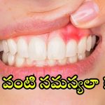 Gums Problem:చిగుళ్ల నుంచి రక్తం కారుతోందా ? కారణం ఇదేనట !
