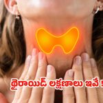 Thyroid: ప్రారంభంలోనే.. థైరాయిడ్‌కు చెక్ పెట్టండిలా !