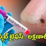 Scrub Typhus Cases: ఏపీలోని ఈ జిల్లాల్లో విజృంభిస్తున్న స్క్రబ్ టైఫస్.. వామ్మో ఇంత ప్రమాదమా?