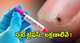 Smartphone Comparison: ఐకూ 15 vs రియల్ మి GT 8 ప్రో vs ఒప్పో ఫైండ్ X9.. మూడు కొత్త ఫ్లాగ్‌షిప్ల మధ్య పోటీ