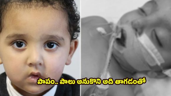 Baby Suffered Heart Attack: 13 నెలల పసిపాప నాలుకను తీసేసిన డాక్టర్లు.. అది తాగిన వెంటనే హార్ట్ ఎటాక్, చివరికి..