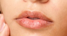 Dry Lips: చలికాలంలో మృదువైన పెదాల కోసం.. ఈటిప్స్ ఫాలో అవ్వండి
