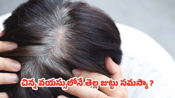 Grey Hair: కొంత మందికి.. చిన్న వయస్సులోనే తెల్ల జుట్టు ఎందుకొస్తుంది ?