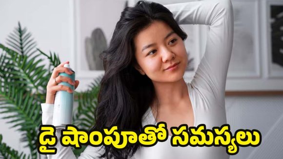 Dry Shampoo: డ్రై షాంపూ వాడటం ప్రమాదకరమా ? నిపుణులు ఏం చెబుతున్నారంటే ?