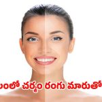 Winter Skin Care: చలికాలంలో చర్మం రంగు మారుతుందా ? ఈ టిప్స్‌ పాటిస్తే ప్రాబ్లమ్ సాల్వ్