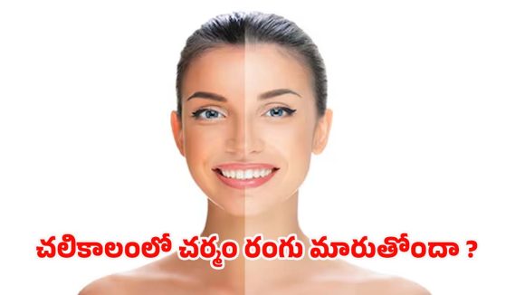 Winter Skin Care: చలికాలంలో చర్మం రంగు మారుతుందా ? ఈ టిప్స్‌ పాటిస్తే ప్రాబ్లమ్ సాల్వ్