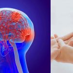 Diabetes And Stroke: రక్తంలో చక్కెర పెరుగుదల.. మెదడును ఎలా ప్రభావితం చేస్తుంది?