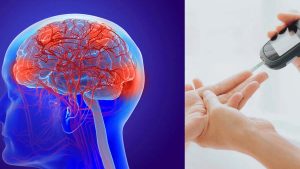Diabetes And Stroke: రక్తంలో చక్కెర పెరుగుదల.. మెదడును ఎలా ప్రభావితం చేస్తుంది?