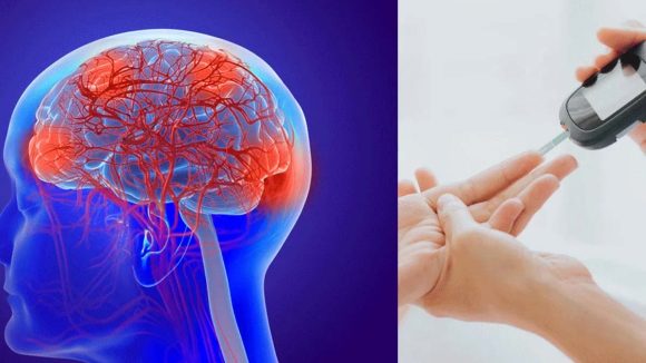 Diabetes And Stroke: రక్తంలో చక్కెర పెరుగుదల.. మెదడును ఎలా ప్రభావితం చేస్తుంది?