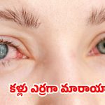 Morning Red Eyes: ఉదయం లేవగానే కళ్ళు ఎర్ర బడుతున్నాయా ? కారణాలు తెలుసుకోకపోతే కష్టమే !
