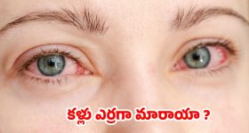 Morning Red Eyes: ఉదయం లేవగానే కళ్ళు ఎర్ర బడుతున్నాయా ? కారణాలు తెలుసుకోకపోతే కష్టమే !