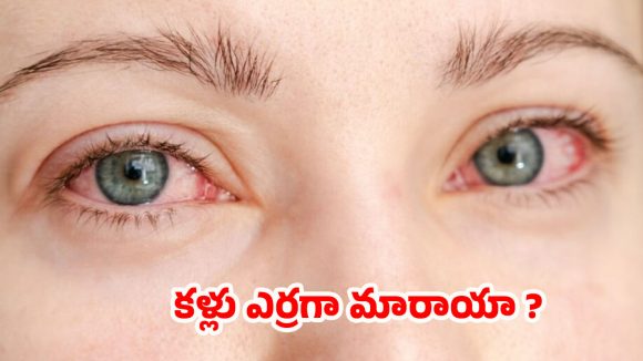 Morning Red Eyes: ఉదయం లేవగానే కళ్ళు ఎర్ర బడుతున్నాయా ? కారణాలు తెలుసుకోకపోతే కష్టమే !