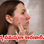 Omega-3 Deficiency: చర్మ సమస్యలా ? అసలు కారణాలివేనట !