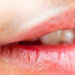 Lip Care In Winter: చలికాలంలో.. పగిలిన పెదాలు స్మూత్‌గా మారాలా ? ఈ టిప్స్ పాటిస్తే చాలు