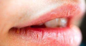 Lip Care In Winter: చలికాలంలో.. పగిలిన పెదాలు స్మూత్‌గా మారాలా ? ఈ టిప్స్ పాటిస్తే చాలు