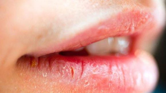 Lip Care In Winter: చలికాలంలో.. పగిలిన పెదాలు స్మూత్‌గా మారాలా ? ఈ టిప్స్ పాటిస్తే చాలు