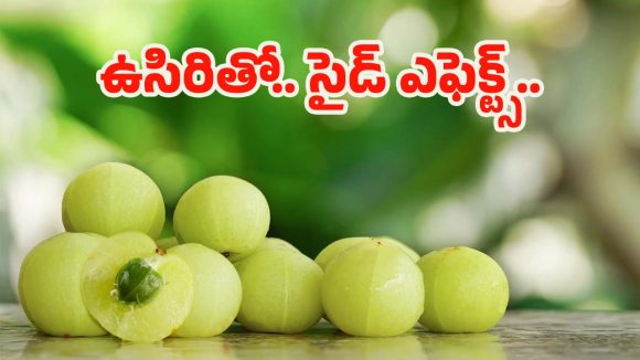 Amla: ఆరోగ్యానికి మంచిదని ఉసిరికాయ ఎక్కువగా తింటున్నారా ? నిపుణులు చెప్పేది వెంటే షాక్ అవుతారు