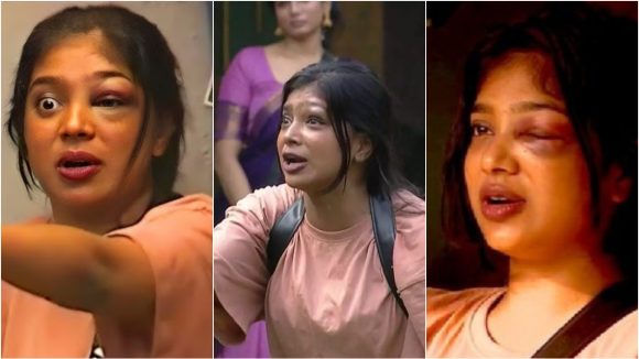 Bigg Boss: కెప్టెన్సీ టాస్క్ లో నటి కంటికి తీవ్ర గాయం.. కమిలిపోయిన కన్ను, వీడియో వైరల్