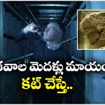 Human Brains: షాకింగ్.. ఆ హాస్పిటల్ అండర్ గ్రౌండ్‌లో 10 వేల మానవ మెదళ్లు, బకెట్లలో వేసి మరీ..