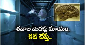 Human Brains: షాకింగ్.. ఆ హాస్పిటల్ అండర్ గ్రౌండ్‌లో 10 వేల మానవ మెదళ్లు, బకెట్లలో వేసి మరీ..