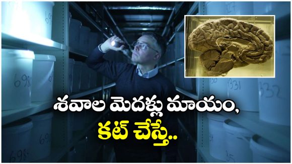 Human Brains: షాకింగ్.. ఆ హాస్పిటల్ అండర్ గ్రౌండ్‌లో 10 వేల మానవ మెదళ్లు, బకెట్లలో వేసి మరీ..