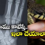 Viral News: పాము కాటేసిందని వేలు కట్ చేసుకున్నాడు.. డాక్టర్ చెప్పింది విని బుర్ర బాదుకున్నాడు!