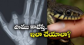 Winter Skin Care: చలికాలంలో చర్మం రంగు మారుతుందా ? ఈ టిప్స్‌ పాటిస్తే ప్రాబ్లమ్ సాల్వ్