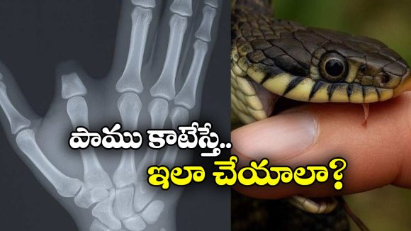 Viral News: పాము కాటేసిందని వేలు కట్ చేసుకున్నాడు.. డాక్టర్ చెప్పింది విని బుర్ర బాదుకున్నాడు!