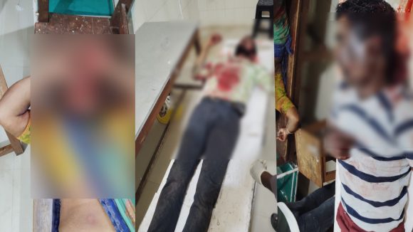 Nagarkurnool: కల్వకుర్తిలో దారుణం.. వివాహేతర సంబంధం నెపంతో ఒకే కుటుంబంపై వేట కొడవళ్లతో దాడి