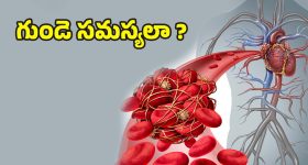 Heart Blockage: మీ గుండె ఆరోగ్యం ప్రమాదంలో ఉందా? ఈ 5 లక్షణాలు కనిపిస్తే వెంటనే అలర్ట్ అవ్వండి