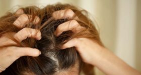 Itchy Scalp: తలపై దురదతో.. ఇబ్బంది పడుతున్నారా ? ఈ టిప్స్ మీకోసమే !