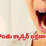 Oral Cancer: నోటి క్యాన్సర్ ప్రారంభ లక్షణాలు.. అస్సలు నిర్లక్ష్యం చేయొద్దు !