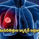 Lung cancer: ఊపిరితిత్తుల క్యాన్సర్.. ప్రతి ఒక్కరూ గమనించాల్సిన ప్రారంభ లక్షణాలు !