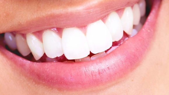 Tips For Teeth: మెరిసే తెల్లటి పళ్లు, ఆకర్షణీయమైన చిరునవ్వు కోసం చిట్కాలు !
