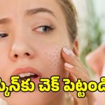 Dry Skin in Winter: చలికాలంలో డ్రై స్కిన్ సమస్యకు.. వీటితో చెక్ !