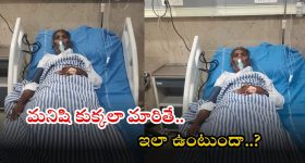 Anantapur: రేయ్.. మీరు మనుషులా..? కుక్కలా..? మరీ ఆ ప్లేస్‌లో అలా కొరకవచ్చా..!