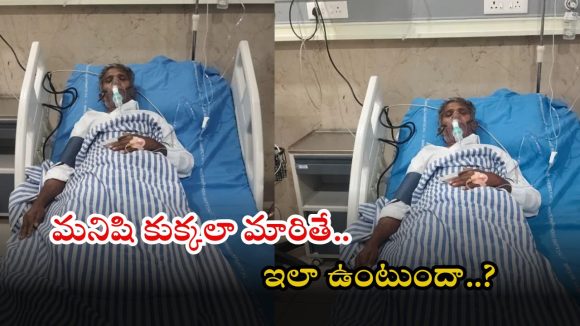 Anantapur: రేయ్.. మీరు మనుషులా..? కుక్కలా..? మరీ ఆ ప్లేస్‌లో అలా కొరకవచ్చా..!