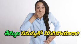 Belching: పదే పదే పుల్లని తేన్పులు వేధిస్తున్నాయా?.. వాటిని అంతం చేసే చిట్కాలివిగో పట్టండి!