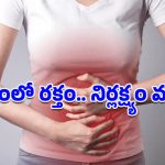 Blood Stool: మలం నుంచి రక్తం పడుతోందా? పైల్స్ కాదు.. ఈ భయానక వ్యాధి కూడా కావచ్చు, జాగ్రత్త
