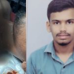 Keesara Kite String Injury: సంక్రాంతి సంబరమా.. మృత్యు పాశమా? చైనా మాంజా ధాటికి యువకుడికి 19 కుట్లు! కీసరలో విషాదం
