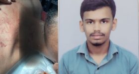 Keesara Kite String Injury: సంక్రాంతి సంబరమా.. మృత్యు పాశమా? చైనా మాంజా ధాటికి యువకుడికి 19 కుట్లు! కీసరలో విషాదం