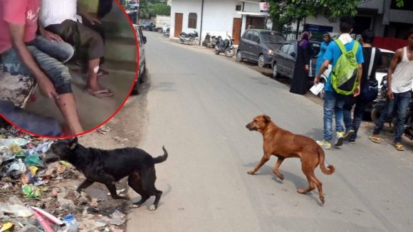 Dog Attack: పిచ్చి కుక్క స్వైర విహారం,  36 మందిపై దాడి, ఆసుపత్రికి బాధితులు, బెంబేలెత్తిపోయిన ప్రజలు