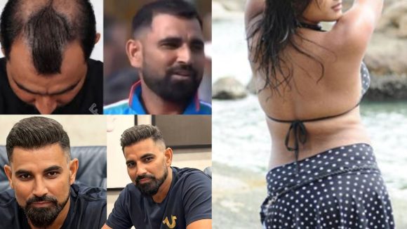 Mohammed Shami: బట్టతలకు చెక్‌..ఆ అమ్మాయితో మ‌హ‌మ్మ‌ద్ ష‌మీ ఎ*ఫైర్ ?