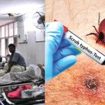 Scrub Typhus Cases: ఏపీలో వణికిస్తున్న స్క్రబ్ టైఫ‌స్ కేసులు..  అన్ని జిల్లాల్లో నమోదు, డాక్టర్లు ఏమంటున్నారు?