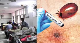 Scrub Typhus Cases: ఏపీలో వణికిస్తున్న స్క్రబ్ టైఫ‌స్ కేసులు..  అన్ని జిల్లాల్లో నమోదు, డాక్టర్లు ఏమంటున్నారు?
