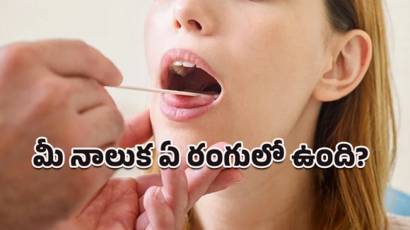 Tongue Health: మీ ఆరోగ్యానికి అద్దం నాలుకే!.. రుచి మాత్రమే కాదు, ఆరోగ్యమైన సంకేతాలూ చెబుతోంది!
